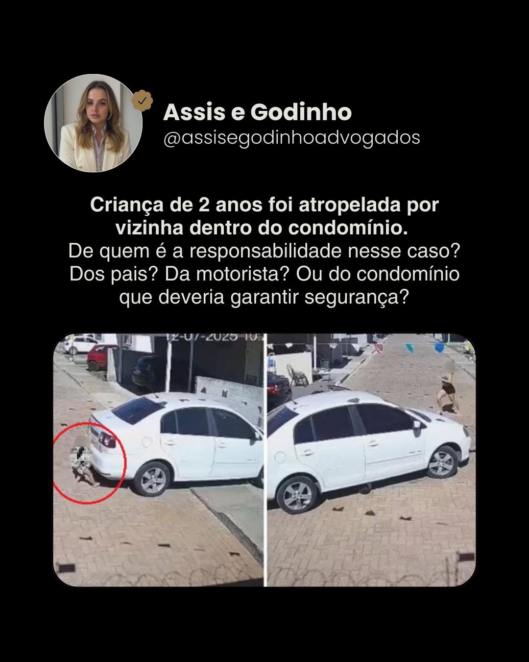 Caso real em Goiânia: uma criança de apenas 2 anos foi atropelada dentro do condomínio após correr atrás de uma bola. Felizmente, sem ferimentos graves. A polêmica é: quem deve responder em situações assim? Os pais, pela falta de vigilância? A motorista, que deveria redobrar a atenção em áreas residenciais? Ou o condomínio, que deveria adotar medidas de segurança (sinalização, redutores de velocidade, campanhas de conscientização)? O debate é necessário: acidentes em áreas comuns levantam discussões sobre limites de responsabilidade dentro da vida condominial.